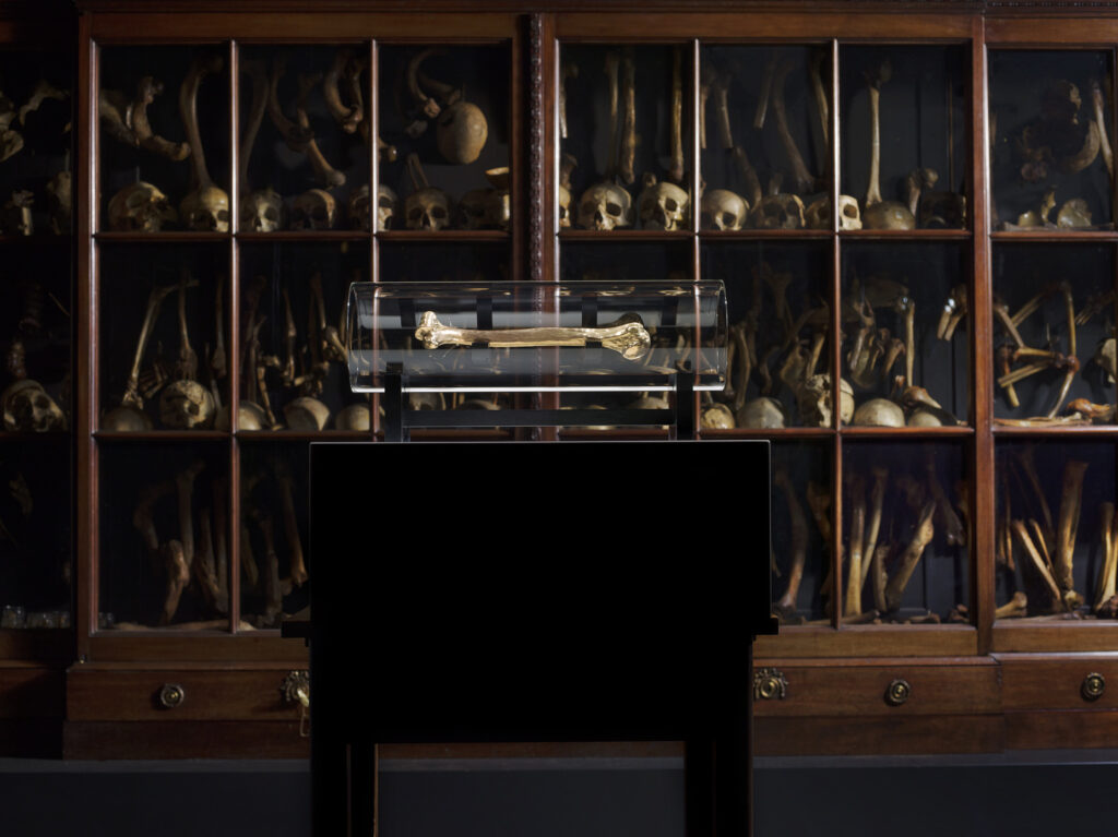 Skeleton_Self_portrait_20_1_Caspar_Berger